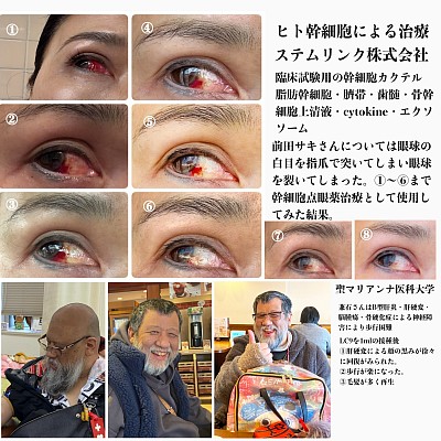 幹細胞2